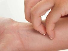 دبلوم تقنية نايت لعلاج الحساسية NAET
