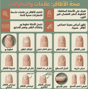 دبلوم تشخيص الأمراض عبر الأظافر