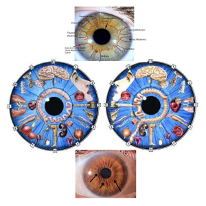 دبلوم علم التشخيص القزحي – التشخيص الحدقي – المستوى الأول