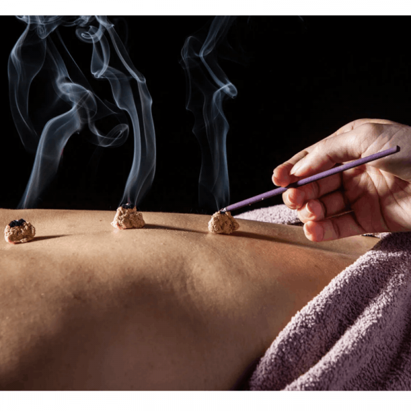 دبلوم العلاج بالكي الصيني (موكسا)