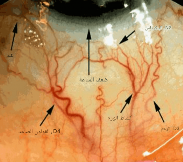 دبلوم التشخيص عن طريق بياض العين (الصلبة) مستوى 1 و2