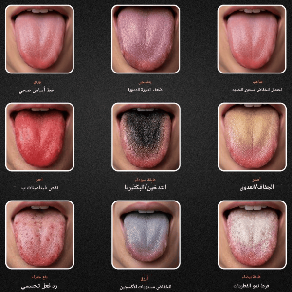 tongue-diagnosis دبلوم تشخيص الأمراض عبر اللسان في الطب الصيني